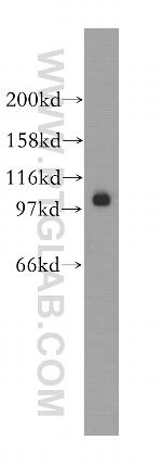 SALL2 Antibody in Western Blot (WB)