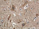 gephyrin Antibody in Immunohistochemistry (Paraffin) (IHC (P))