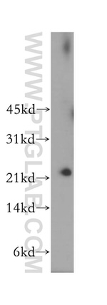 MAD2L2 Antibody in Western Blot (WB)