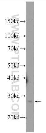 MAD2L2 Antibody in Western Blot (WB)