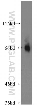 EAAT3 Antibody in Western Blot (WB)