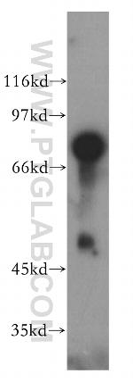 BHLHE41 Antibody in Western Blot (WB)