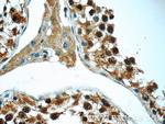 MNS1 Antibody in Immunohistochemistry (Paraffin) (IHC (P))