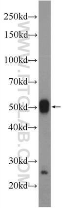 MNS1 Antibody in Western Blot (WB)