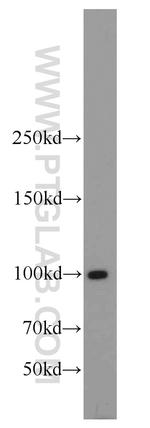 LIG4 Antibody in Western Blot (WB)
