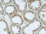 LIG4 Antibody in Immunohistochemistry (Paraffin) (IHC (P))