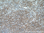 SGK3 Antibody in Immunohistochemistry (Paraffin) (IHC (P))