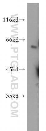 SGK3 Antibody in Western Blot (WB)