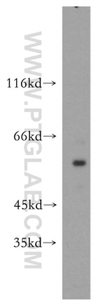 SGK3 Antibody in Western Blot (WB)