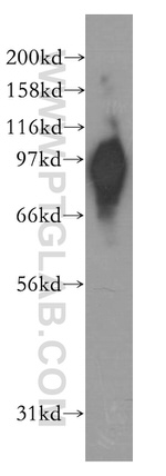 KIFAP3 Antibody in Western Blot (WB)