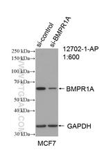 BMPR1A Antibody in Western Blot (WB)
