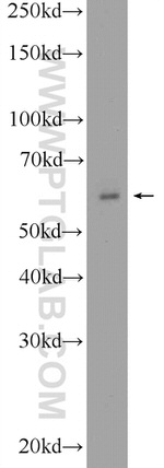 BMPR1A Antibody in Western Blot (WB)