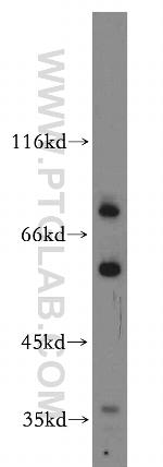 SHKBP1 Antibody in Western Blot (WB)