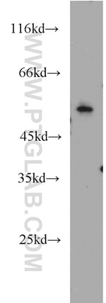 NEK11 Antibody in Western Blot (WB)
