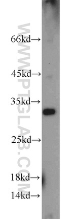 NEK11 Antibody in Western Blot (WB)