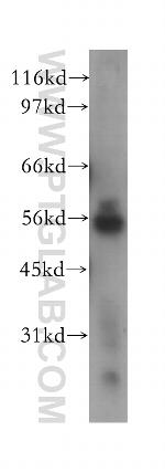NEK11 Antibody in Western Blot (WB)
