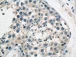 GCNF Antibody in Immunohistochemistry (Paraffin) (IHC (P))