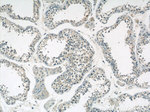 GCNF Antibody in Immunohistochemistry (Paraffin) (IHC (P))