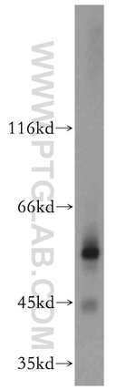GCNF Antibody in Western Blot (WB)