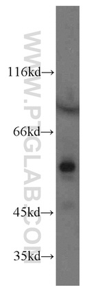 GCNF Antibody in Western Blot (WB)