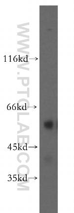 GCNF Antibody in Western Blot (WB)