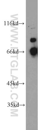 QSOX1 Antibody in Western Blot (WB)
