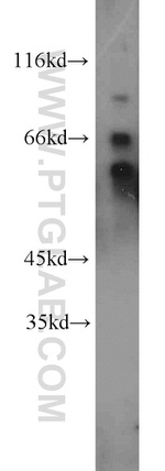 QSOX1 Antibody in Western Blot (WB)