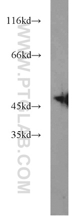 ZNF238 Antibody in Western Blot (WB)