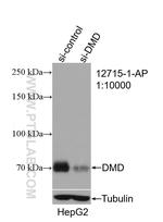 Dystrophin Antibody in Western Blot (WB)