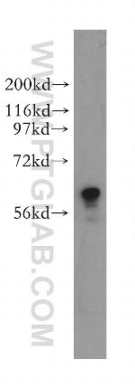 TROVE2 Antibody in Western Blot (WB)