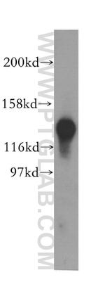 SKIV2L2 Antibody in Western Blot (WB)