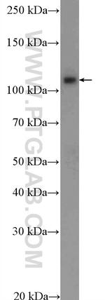 SKIV2L2 Antibody in Western Blot (WB)