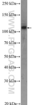 SKIV2L2 Antibody in Western Blot (WB)