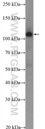 SKIV2L2 Antibody in Western Blot (WB)