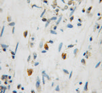 GRPEL1 Antibody in Immunohistochemistry (Paraffin) (IHC (P))