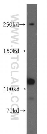 EXOC6 Antibody in Western Blot (WB)