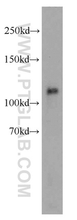 EXOC6 Antibody in Western Blot (WB)