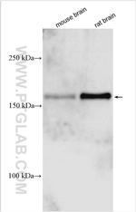 TRPM3 Antibody in Western Blot (WB)