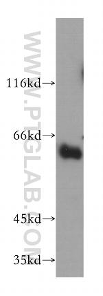 Synaptotagmin-3 Antibody in Western Blot (WB)