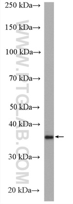 VASH1 Antibody in Western Blot (WB)