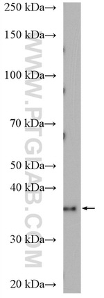 VASH1 Antibody in Western Blot (WB)