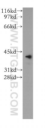VASH1 Antibody in Western Blot (WB)