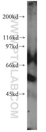 RabGEF1 Antibody in Western Blot (WB)