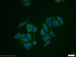 RabGEF1 Antibody in Immunocytochemistry (ICC/IF)