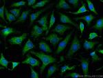 Collagen Type XXV Antibody in Immunocytochemistry (ICC/IF)
