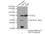 ORC2L Antibody in Immunoprecipitation (IP)