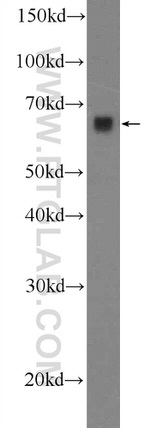 ORC2L Antibody in Western Blot (WB)