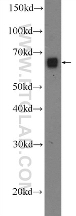 ORC2L Antibody in Western Blot (WB)