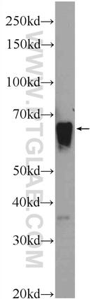 SERPIND1 Antibody in Western Blot (WB)