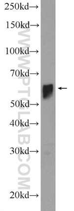 SERPIND1 Antibody in Western Blot (WB)